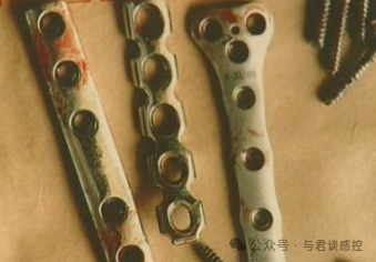 术中取出的骨科植入物如何处理？